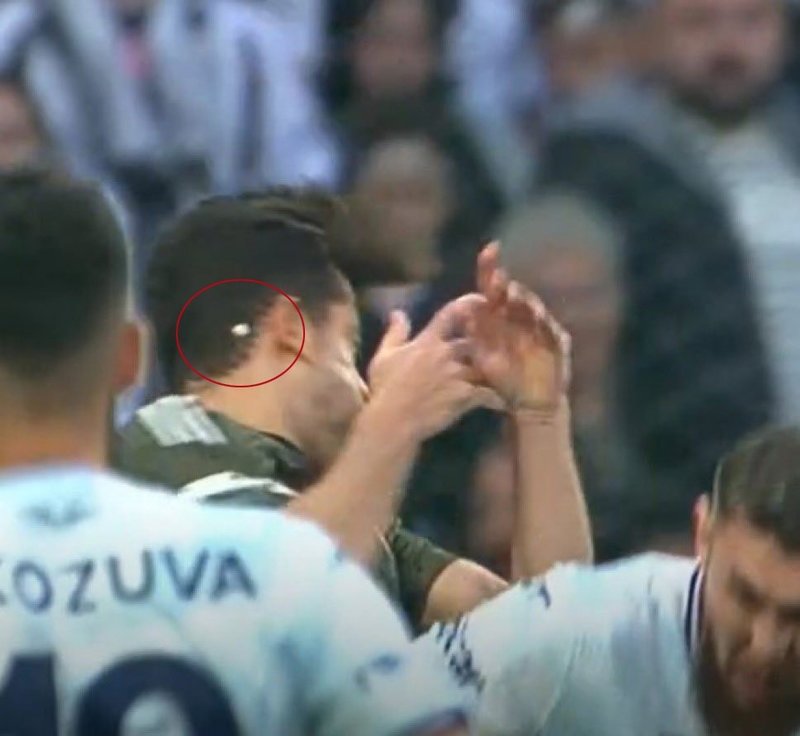 besiktasta gabriel paulistanin disi kirildi 0